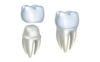 Crown Tooth Home Page Services